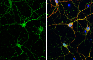 Anti-Calbindin + Calretinin antibody [HL1787] used in Immunocytochemistry/ Immunofluorescence (ICC/IF). GTX637439