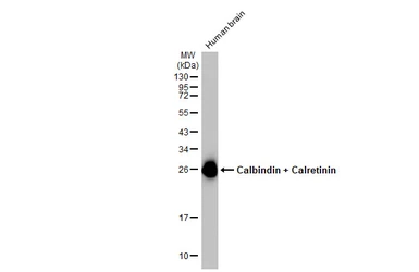 Anti-Calbindin + Calretinin antibody [HL1787] used in Western Blot (WB). GTX637439