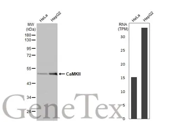 Anti-CaMKII antibody [HL1831] used in Western Blot (WB). GTX637556