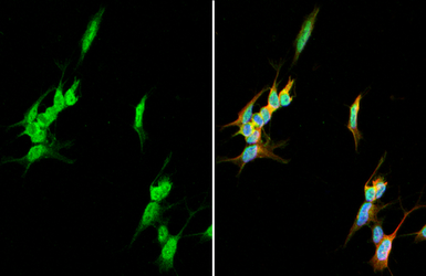 Anti-CaMKII antibody [HL1831] used in Immunocytochemistry/ Immunofluorescence (ICC/IF). GTX637556