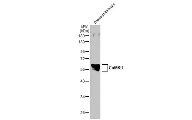 Anti-CaMKII antibody [HL1831] used in Western Blot (WB). GTX637556