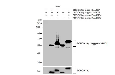 Anti-CaMKII antibody [HL1831] used in Western Blot (WB). GTX637556