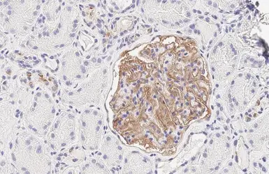 Anti-GPRC5A antibody [HL1864] used in IHC (Paraffin sections) (IHC-P). GTX637589