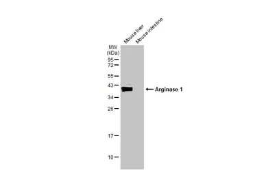 Anti-Arginase 1 antibody [HL1891] used in Western Blot (WB). GTX637640