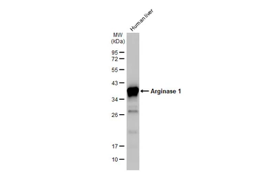 Anti-Arginase 1 antibody [HL1891] used in Western Blot (WB). GTX637640