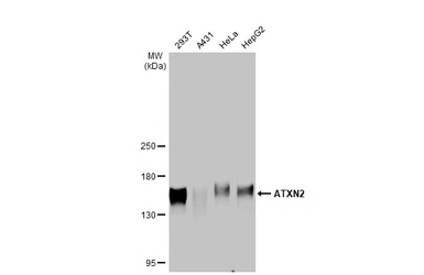 Anti-ATXN2 antibody [HL1902] used in Western Blot (WB). GTX637651