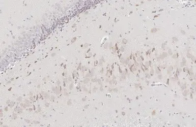 Anti-ATXN2 antibody [HL1902] used in IHC (Paraffin sections) (IHC-P). GTX637651