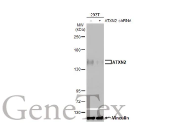 Anti-ATXN2 antibody [HL1903] used in Western Blot (WB). GTX637652