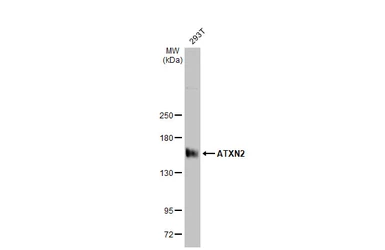 Anti-ATXN2 antibody [HL1903] used in Western Blot (WB). GTX637652