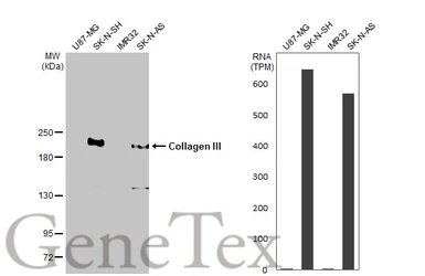 Anti-Collagen III antibody [HL1906] used in Western Blot (WB). GTX637655