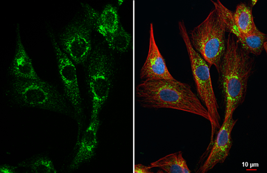 Anti-Collagen III antibody [HL1906] used in Immunocytochemistry/ Immunofluorescence (ICC/IF). GTX637655