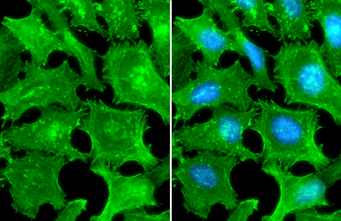 Anti-beta Actin antibody [HL1926] used in Immunocytochemistry/ Immunofluorescence (ICC/IF). GTX637675