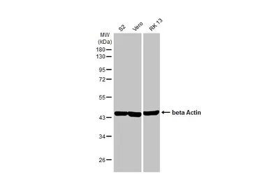 Anti-beta Actin antibody [HL1926] used in Western Blot (WB). GTX637675