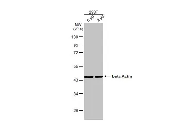 Anti-beta Actin antibody [HL1926] used in Western Blot (WB). GTX637675