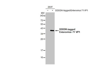 Anti-Enterovirus 71 VP1 antibody [HL1928] used in Western Blot (WB). GTX637687