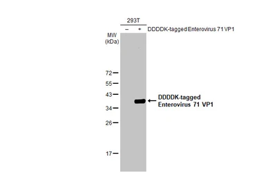 Anti-Enterovirus 71 VP1 antibody [HL1929] used in Western Blot (WB). GTX637688