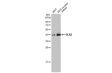 Anti-DLX2 antibody [HL1942] used in Western Blot (WB). GTX637779