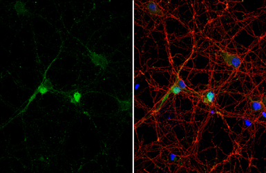 Anti-DLX2 antibody [HL1942] used in Immunocytochemistry/ Immunofluorescence (ICC/IF). GTX637779