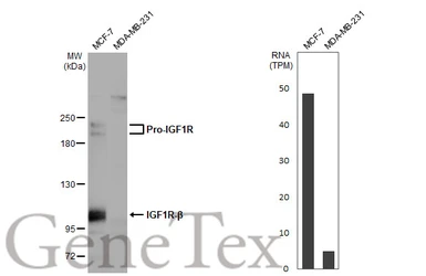 Anti-IGF1R beta antibody [HL1957] used in Western Blot (WB). GTX637794