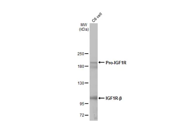 Anti-IGF1R beta antibody [HL1957] used in Western Blot (WB). GTX637794