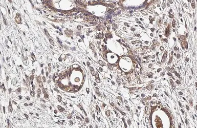 Anti-IGF1R beta antibody [HL1957] used in IHC (Paraffin sections) (IHC-P). GTX637794