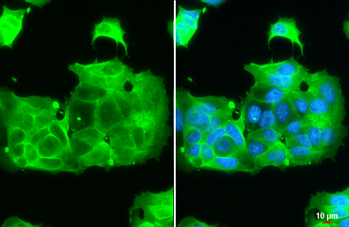 Anti-IGF1R beta antibody [HL1957] used in Immunocytochemistry/ Immunofluorescence (ICC/IF). GTX637794