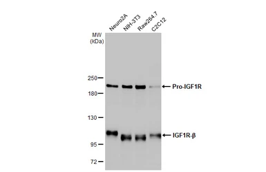 Anti-IGF1R beta antibody [HL1957] used in Western Blot (WB). GTX637794