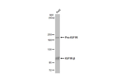 Anti-IGF1R beta antibody [HL1958] used in Western Blot (WB). GTX637795