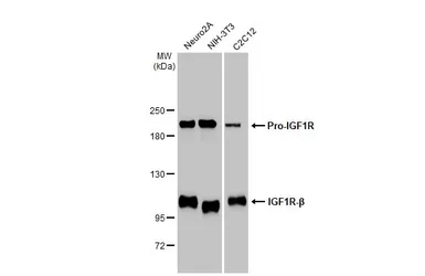 Anti-IGF1R beta antibody [HL1958] used in Western Blot (WB). GTX637795