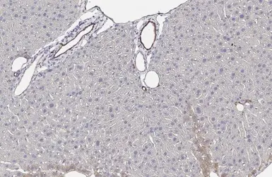 Anti-IGF1R beta antibody [HL1958] used in IHC (Paraffin sections) (IHC-P). GTX637795