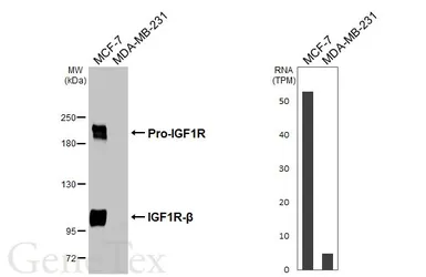 Anti-IGF1R beta antibody [HL1958] used in Western Blot (WB). GTX637795