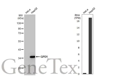 Anti-GPD1 antibody [HL1959] used in Western Blot (WB). GTX637796