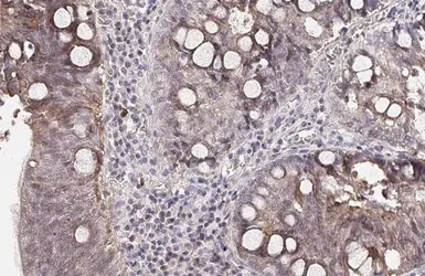 Anti-Apolipoprotein B antibody [HL1960] used in IHC (Paraffin sections) (IHC-P). GTX637797