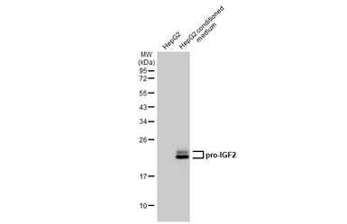 Anti-IGF2 antibody [HL1979] used in Western Blot (WB). GTX637872