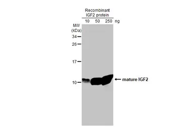 Anti-IGF2 antibody [HL1982] used in Western Blot (WB). GTX637875