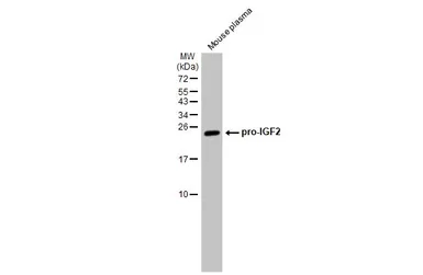 Anti-IGF2 antibody [HL1982] used in Western Blot (WB). GTX637875