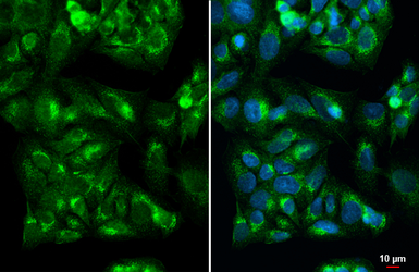 Anti-IGF2 antibody [HL1982] used in Immunocytochemistry/ Immunofluorescence (ICC/IF). GTX637875