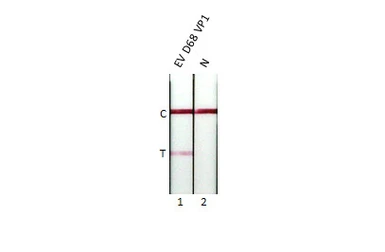 Anti-Enterovirus D68 VP1 antibody [HL1997] used in Lateral Flow (Lateral Flow). GTX637898