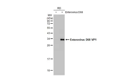 Anti-Enterovirus D68 VP1 antibody [HL1997] used in Western Blot (WB). GTX637898