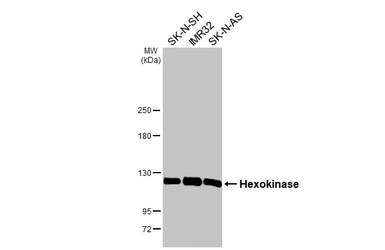 Anti-Hexokinase antibody [HL2000] used in Western Blot (WB). GTX637901