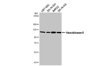 Anti-Hexokinase II antibody [HL2001] used in Western Blot (WB). GTX637902