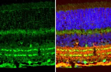 Anti-Choline Acetyltransferase antibody [HL2014] used in IHC (Paraffin sections) (IHC-P). GTX637915