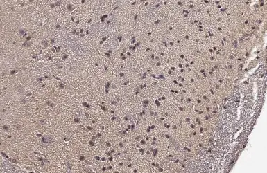 Anti-Choline Acetyltransferase antibody [HL2014] used in IHC (Paraffin sections) (IHC-P). GTX637915