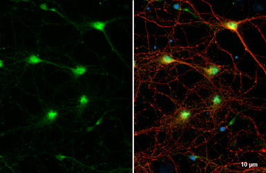 Anti-Choline Acetyltransferase antibody [HL2014] used in Immunocytochemistry/ Immunofluorescence (ICC/IF). GTX637915