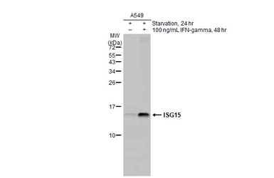 Anti-ISG15 antibody [HL2016] used in Western Blot (WB). GTX637917