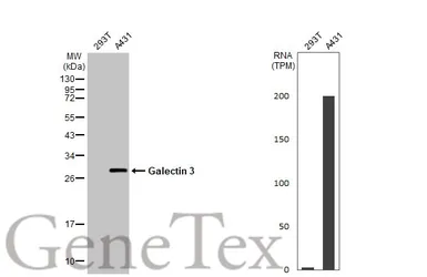 Anti-Galectin 3 antibody [HL2020] used in Western Blot (WB). GTX637921