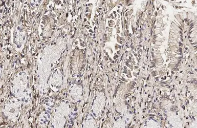 Anti-Galectin 3 antibody [HL2020] used in IHC (Paraffin sections) (IHC-P). GTX637921