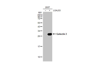 Anti-Galectin 3 antibody [HL2020] used in Western Blot (WB). GTX637921