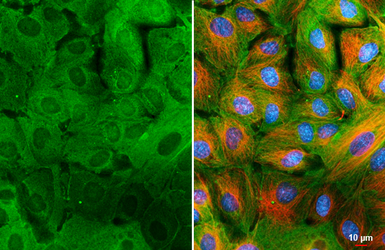 Anti-Galectin 3 antibody [HL2020] used in Immunocytochemistry/ Immunofluorescence (ICC/IF). GTX637921