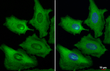 Anti-Galectin 3 antibody [HL2020] used in Immunocytochemistry/ Immunofluorescence (ICC/IF). GTX637921